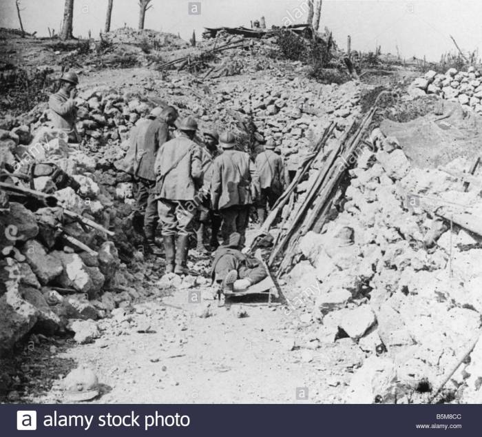 wwi-french-field-hosptial-thiaumont-history-wwi-B5M8CC