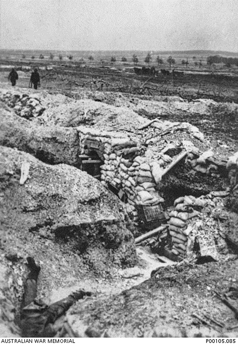 A1 Merville trench